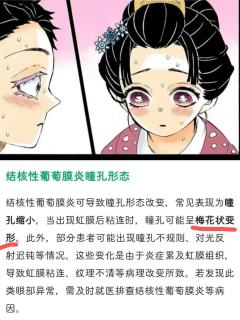 不得不说鳄鱼老师太细节了
恋雪那么美的瞳孔竟然是结核性葡萄膜