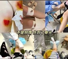 黑粉不要骂鞠婧祎了，小鞠她真的没有整容！